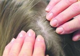Sute de elevi ieşeni găsiţi cu păduchi la început de an şcolar