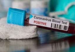 Oficial avem 906 cazuri de persoane infectate cu virusul COVID–19