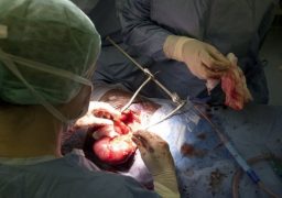 Transplanturi în serie la Spitalul „Parhon“: Patru bărbaţi au primit câte un rinichi